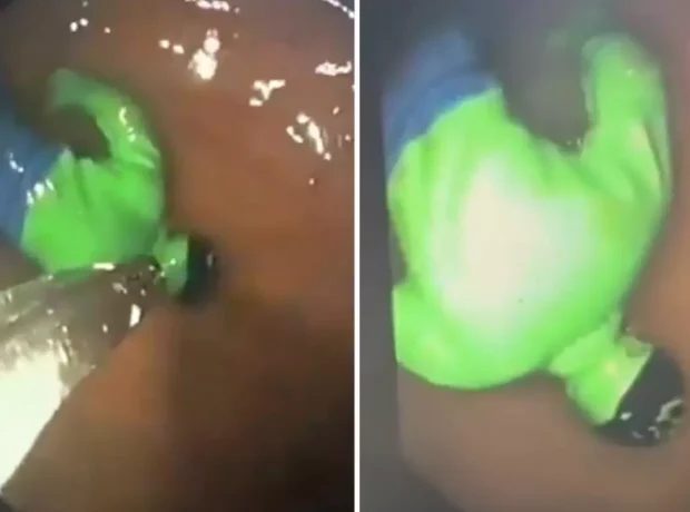 image-hindistan-da-cocugun-midesinden-hulk-cikti-19538512_9252_amp